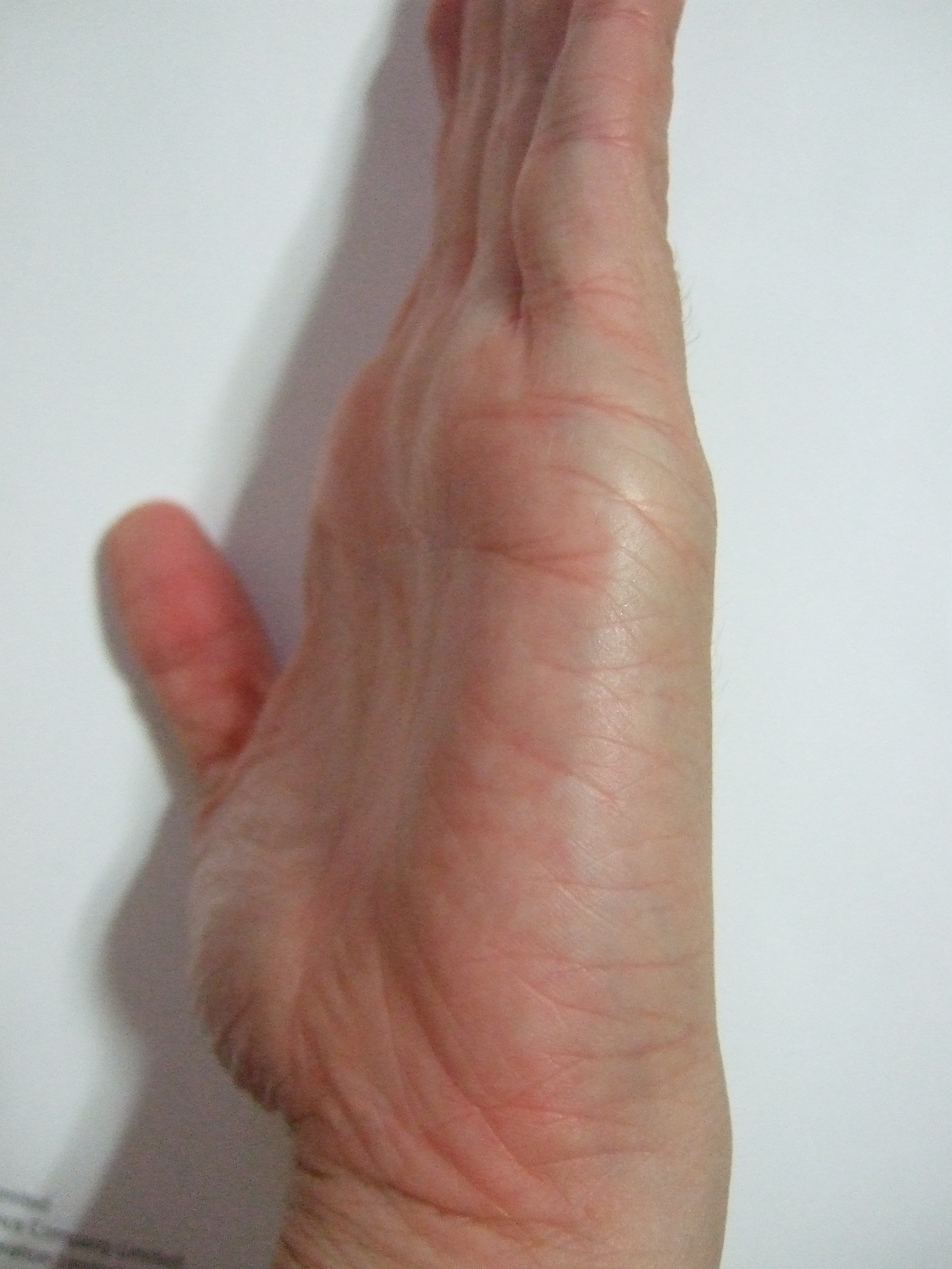 left - side.JPG